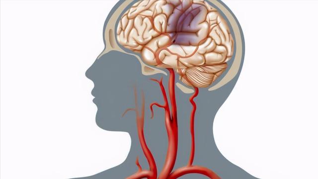 两性生活：几块钱一瓶的维生素B6有助改善睡眠、预防脑梗，科学服用注意4点