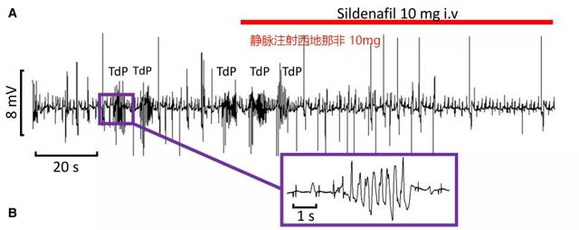 在线商城：英国学者最新发现，壮阳药“伟哥”还可抑制心律失常